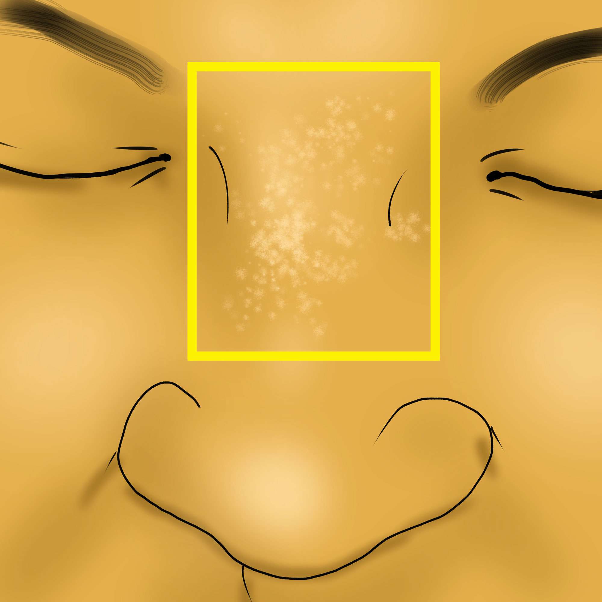 Flat wart on the nose