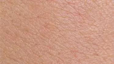 After using Wartovir