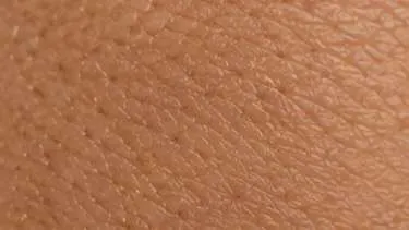 After using Wartovir