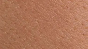 After using Wartovir